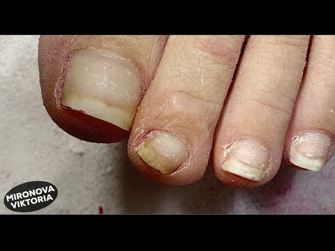 Видео: Педикюр. Обработка пальцев. Покрытие гель лаком.