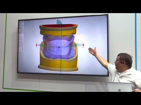Видео: CAD/CAM изготовление протезов BPS (EXPO 2021)