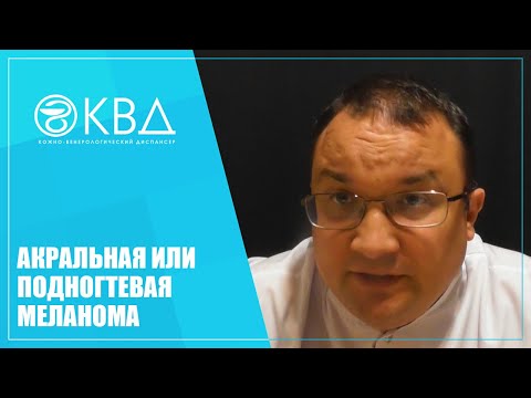 Видео: 1341  Акральная или подногтевая меланома