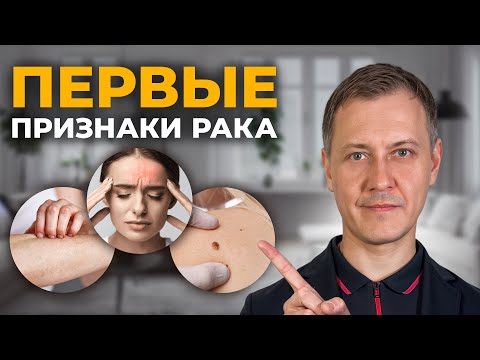 Видео: Как понять что ты болен раком? Не игнорируй эти симптомы