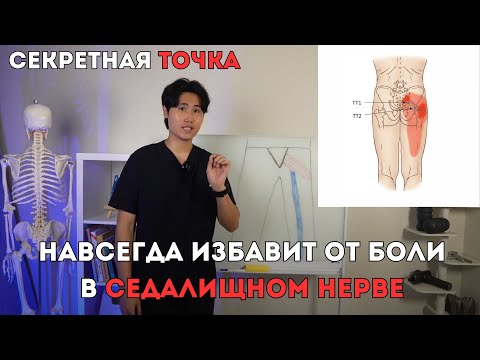 Видео: САМОМАССАЖ ЭТОЙ ТОЧКИ НАВСЕГДА ИЗБАВИТ ОТ БОЛИ В СЕДАЛИЩНОМ НЕРВЕ. ЯГОДИЦА И НОГА БОЛЕТЬ НЕ БУДУТ.