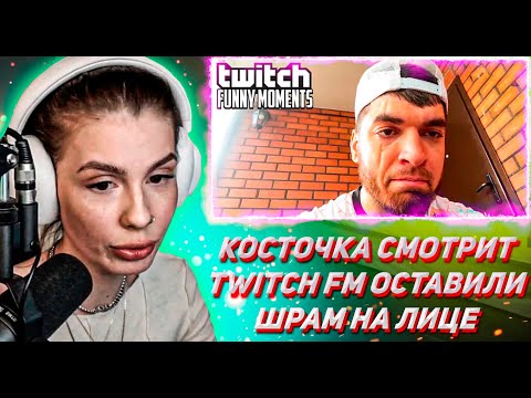 Видео: КОСТОЧКА СМОТРИТ ТВИЧ ФМ Топ Моменты с Twitch | Оставили Шрам на Лице