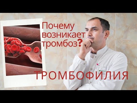 Видео: Почему возникает тромбоз? Тромбофилия. Флеболог Москва.