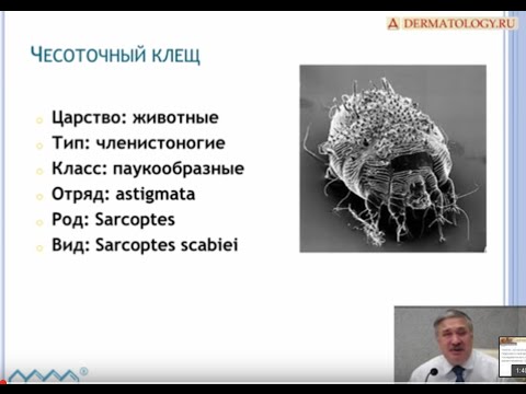 Видео: Телемост на тему: Чесотка - подходы к лечению