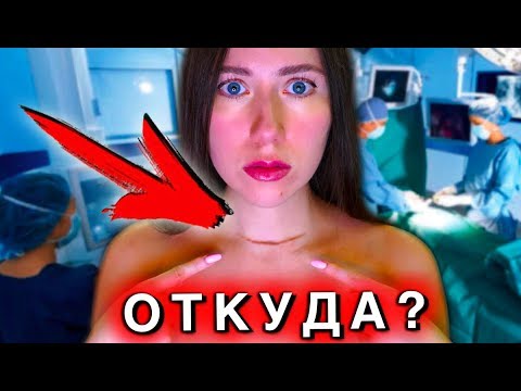 Видео: МОЙ ШРАМ НА ШЕЕ 😭 | Elli Di