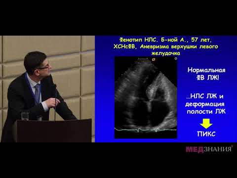Видео: Значение эхокардиографии в выяснении причин СН при сохранной фракции выброса ЛЖ. М. Н. Алехин