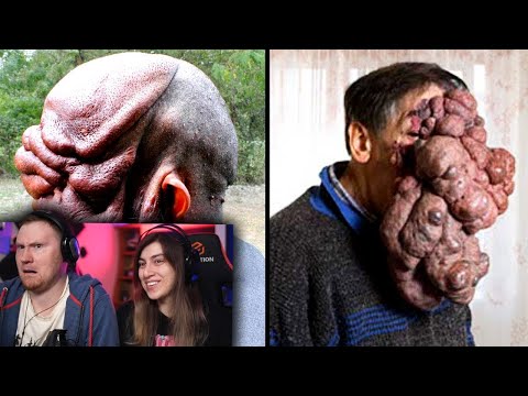 Видео: Люди с Редкими Частями Тела и Способностями | РЕАКЦИЯ на WTFакт