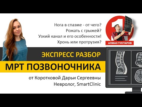 Видео: Разбор МРТ позвоночника - нога в спазме / можно ли рожать / проблемы узкого канала / боль протрузии?