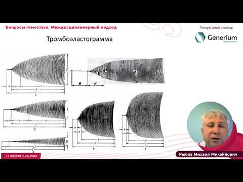 Видео: Проблема диагностики и коррекции гемостаза в кардиохирургии, Рыбка М.М.