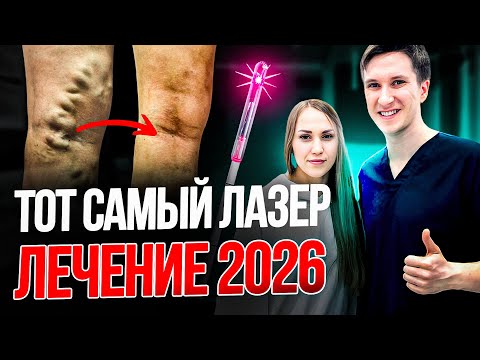 Видео: 30 МИНУТ - И НИКАКОГО ВАРИКОЗА! Вся ПРАВДА о лазерном лечении вен!