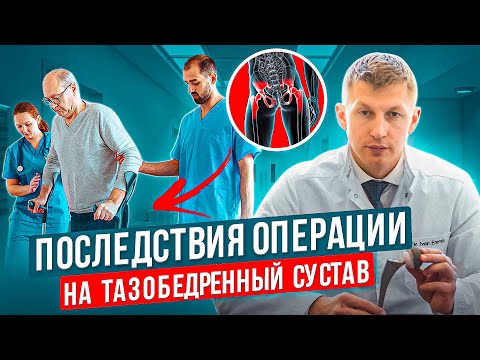 Видео: Какие ограничения вас ждут после эндопротезирования тазобедренного сустава и ждут ли вообще?
