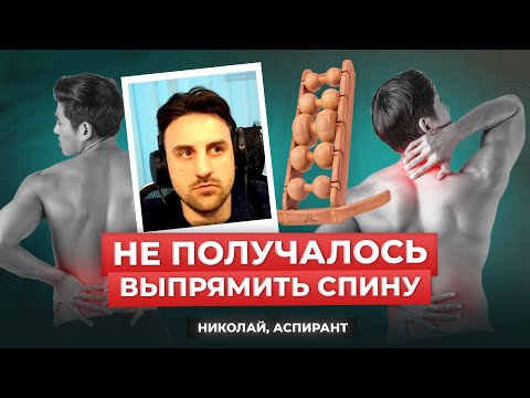 Видео: Николай, 26 лет. С детства была кривая осанка. Сутулость прошла после занятий на массажере для спины