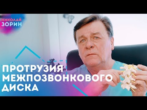 Видео: Что такое протрузия позвоночника и почему ее путают с грыжей. Нейрохируг Зорин Николай Александрович