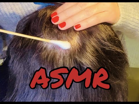 Видео: АСМР Осмотрю твои волосы и кожу головы | ASMR ВЫЛЕЧУ КРАСНЫЕ ПЯТНА на голове | АСМР волосы 👩🏻