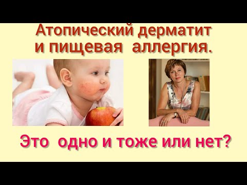Видео: Атопический дерматит и пищевая аллергия- это одно и то же или нет?