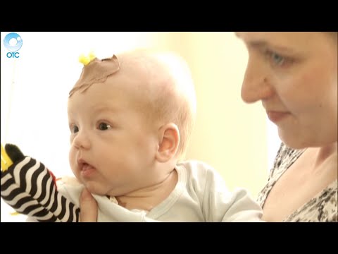 Видео: 4-х месячному Руслану Пилипенко из Новосибирска нужна помощь. У малыша синдром короткой кишки