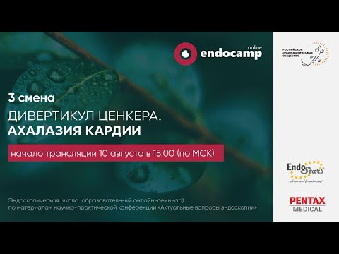Видео: Дивертикул Ценкера. Ахалазия Кардии (день 1)