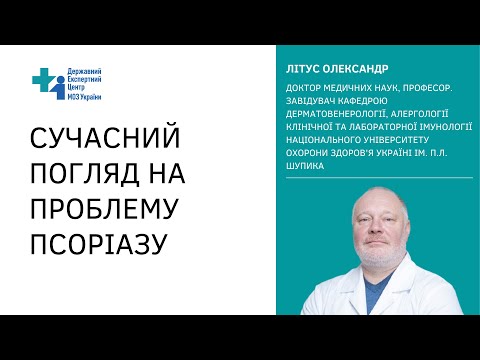 Видео: Псоріаз: причини та симптоми: підхід фахівця Олександра Літуса