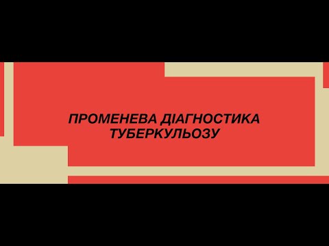Видео: Променева діагностика вторинного туберкульозу легень.