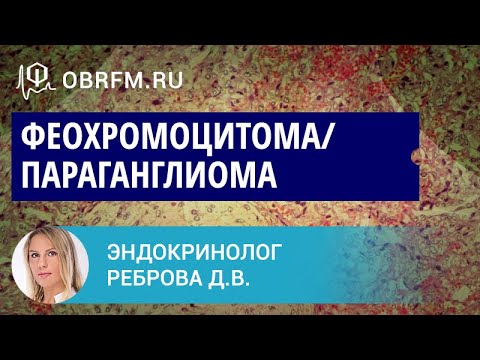 Видео: Эндокринолог Реброва Д.В.: Феохромоцитома/параганглиома