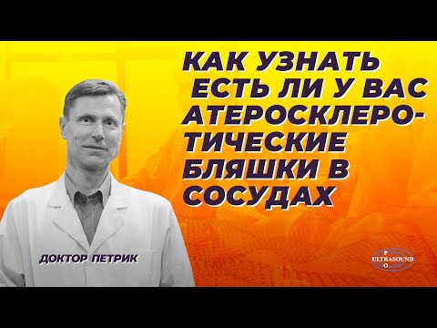 Видео: Как узнать есть ли у вас атеросклеротические бляшки в сосудах.