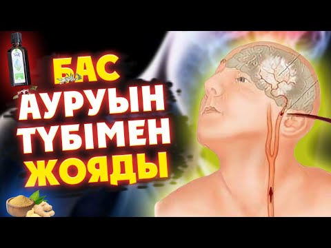 Видео: БАС АУЫРҒАНЫН ОҢАЙ ЕМДЕУДІҢ ҚҰПИЯСЫ АШЫЛДЫ, БАС АУЫРСА ОСЫЛАЙ ІСТЕҢІЗ, Керек арнасы