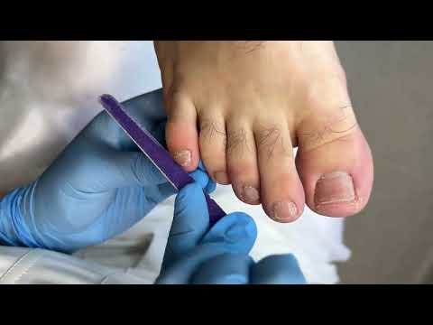 Видео: Педикюр | работа скальпелем | мужская стопа