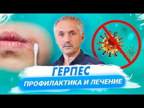 Видео: Причины появления герпеса, методы его диагностики и лечения / Доктор Виктор