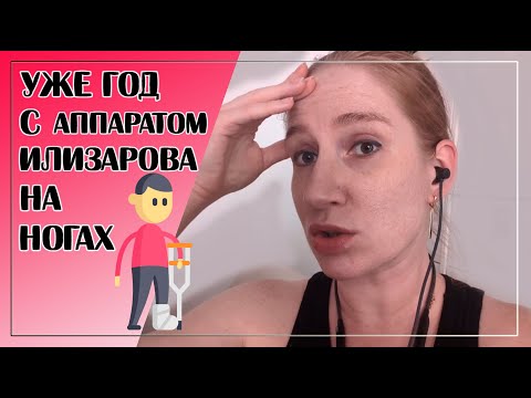 Видео: 20// КАК ДЕЛА У НОЖЕК?