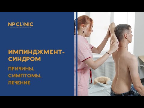 Видео: Импинджмент-синдром: причины, симптомы, лечение