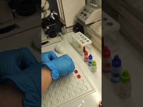 Видео: Определение группы крови и проба на совместимость