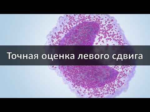Видео: Точная оценка левого сдвига в современном анализе крови. Палочки или новые технологии?