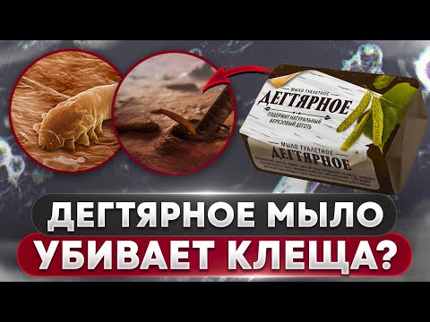 Видео: 🧼 Дегтярное мыло против клеща? | Угревая Железница Demodex