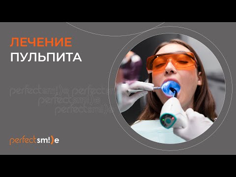 Видео: 🦷​👀​ Лечение пульпита
