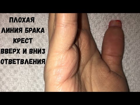 Видео: Смерть партнера. Дефектная линия брака. Крест, вверх и вниз линии. Хиромантия