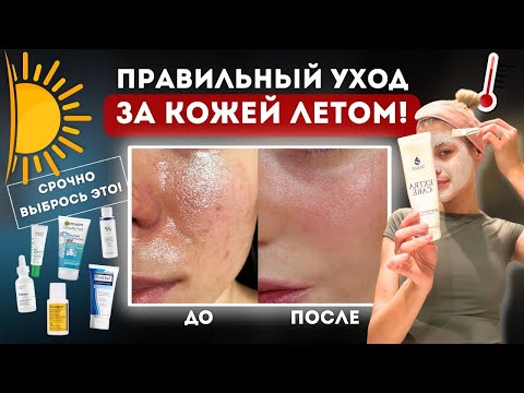 Видео: КАК НЕ ИСПОРТИТЬ КОЖУ ЛЕТОМ | 5 методов правильного ухода за жирной кожей!