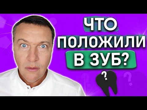 Видео: Какое ЛЕКАРСТВО кладут под временную пломбу? Лечение пульпита и периодонтита под временной пломбой.