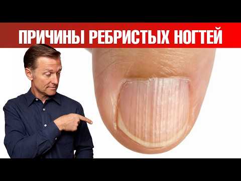 Видео: О чем кричат ваши ногти? Не лечите симптом, ищите ПРИЧИНУ✅