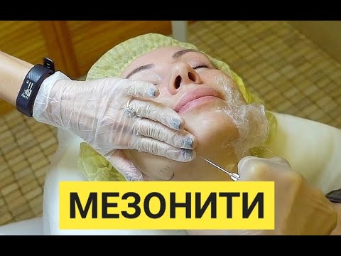 Видео: Ставим мезонити для улучшения овала лица