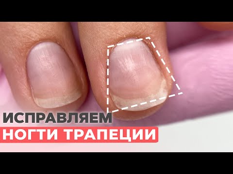 Видео: Исправляем ногти трапеции | Наращивание ногтей гелем