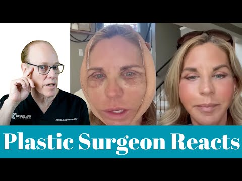 Видео: Подтяжка лица и блефаропластика: история | Реакция пластического хирурга