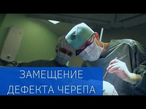 Видео: Современная технология замещения дефекта черепа