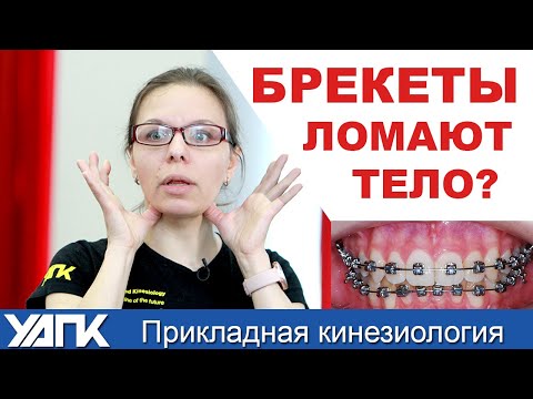 Видео: Как влияют БРЕКЕТЫ  на тело? (Евгения Чижикова)