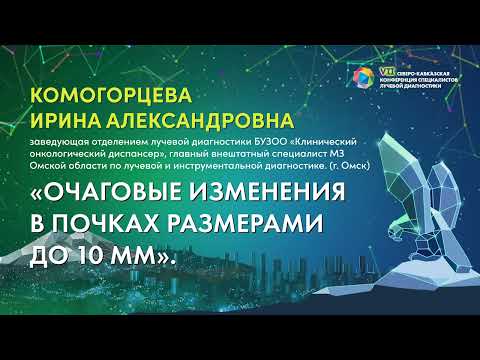 Видео: 02  Очаговые изменения в почках размерами до 10 мм   Игнатьев Юрий Тимофеевич