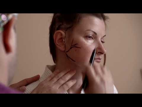 Видео: Восстановление лицевого нерва. Салихов К.С. (полная версия)| АРТ-Клиник, Москва