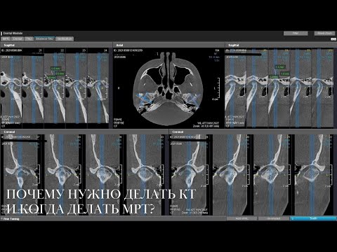 Видео: Почему для консультации нужно делать КТ, и когда нужно делать МРТ?