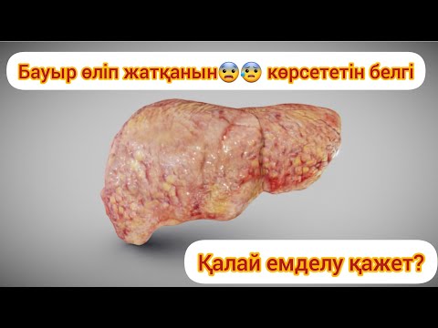 Видео: Бауырды май басу / жировой гепатоз / үй жағдайында емдеу