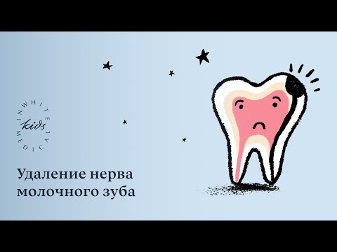 Видео: Пульпит молочных зубов и удаление нерва