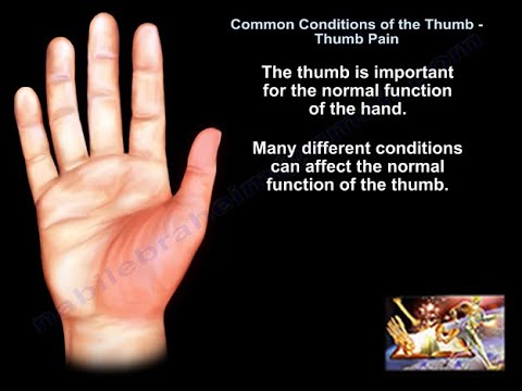 Видео: Распространенные и болезненные состояния большого пальца руки — всё, что вам нужно знать — доктор...