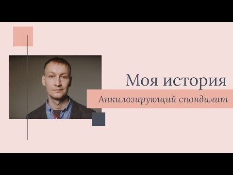 Видео: Моя история: Михаил Падерин об анкилозирующем спондилоартрите и важности ранней диагностики